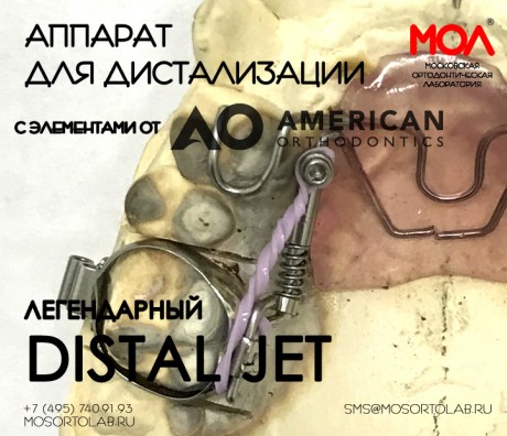 Аппарат Дистал Джет (Distal Jet) с элементами от American Orthodontics®