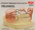 Регулятор функций Френкеля (Frankel) III типа (Frankel III) при мезиальной окклюзии