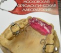 Аппарат Тугарина (несъемный ортодонтический аппарат, НОА) активируемый с «омега» – петлями