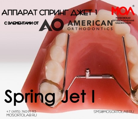 Аппарат Спринг Джет I (Spring Jet I) с элементами от American Orthodontics®