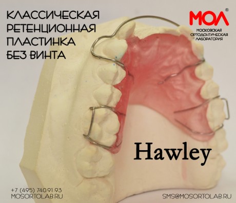 Аппарат Хаулея (Hawley) (классическая ретенционная пластинка без винта)