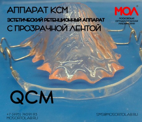 Аппарат КСМ (QCM) (эстетическая ретенционная пластинка с прозрачной силиконовой вестибулярной лентой)