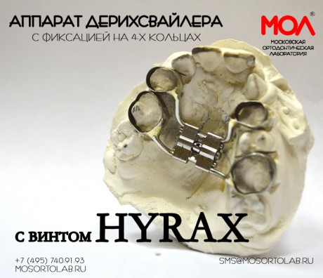 Аппарат Дерихсвайлера с винтом Hyrax с фиксаций на 4-х кольцах со штангами