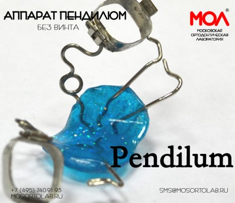 Аппарат Пендилюм (Pendilum) классический по Хилгерсу (Hilgers) (без винта) с фиксацией на 2-х кольцах и окклюзионных лапках